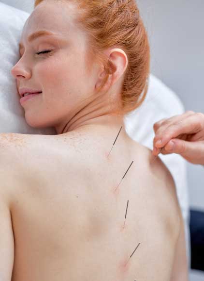 Wie-wirkt-Akupunktur