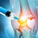 Stammzelltherapie