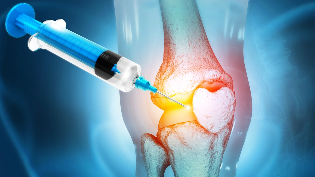 Stammzellen und ihre Bedeutung in der Orthopädie