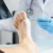 Hallux Valgus